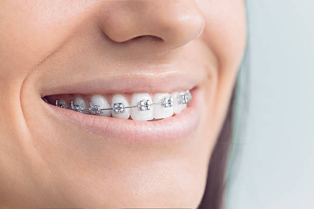 Best Dental Inlays and Onlays  in Billings, MT